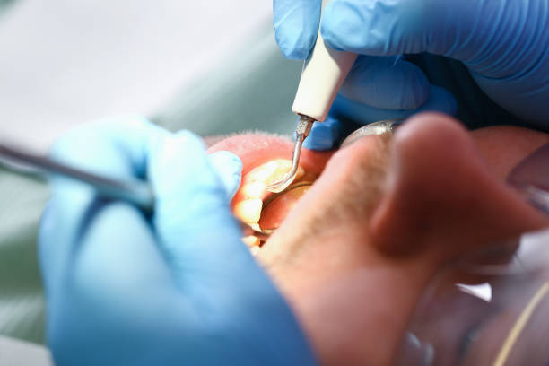 Best Emergency Dentist for Knocked-Out Tooth in Fairmont, IL